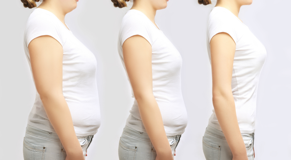 トレーニングや食事改善による、【腹部】や【全身】の体型の変化（ビフォーアフター）を3段階で比較している状況です。ぽっこりお腹がスッキリしていく過程を表しており、徐々に自信を取り戻し、美しく健康になっていく喜びが感じられます。
